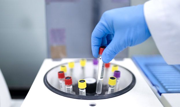Biochemistry Analyzer