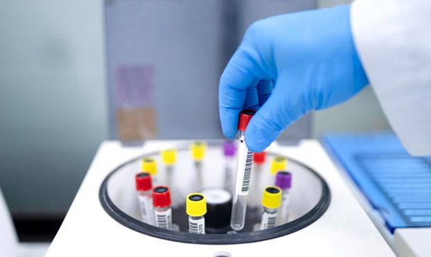 Coagulation Analyzer