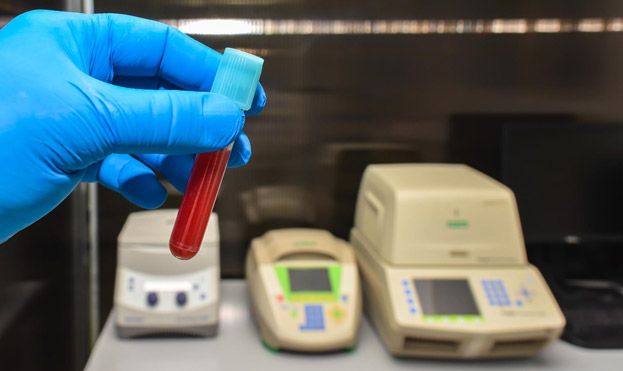 Hematology Analyzer