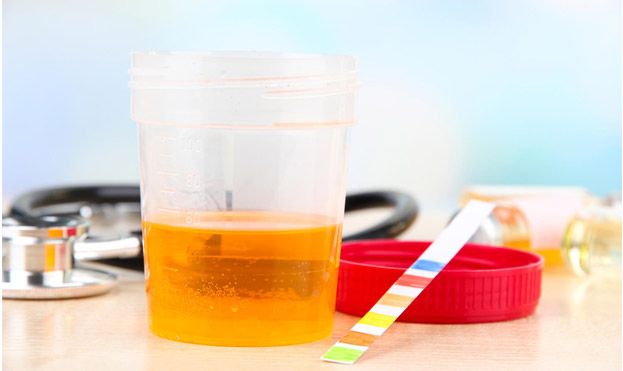 Urine Analyzer
